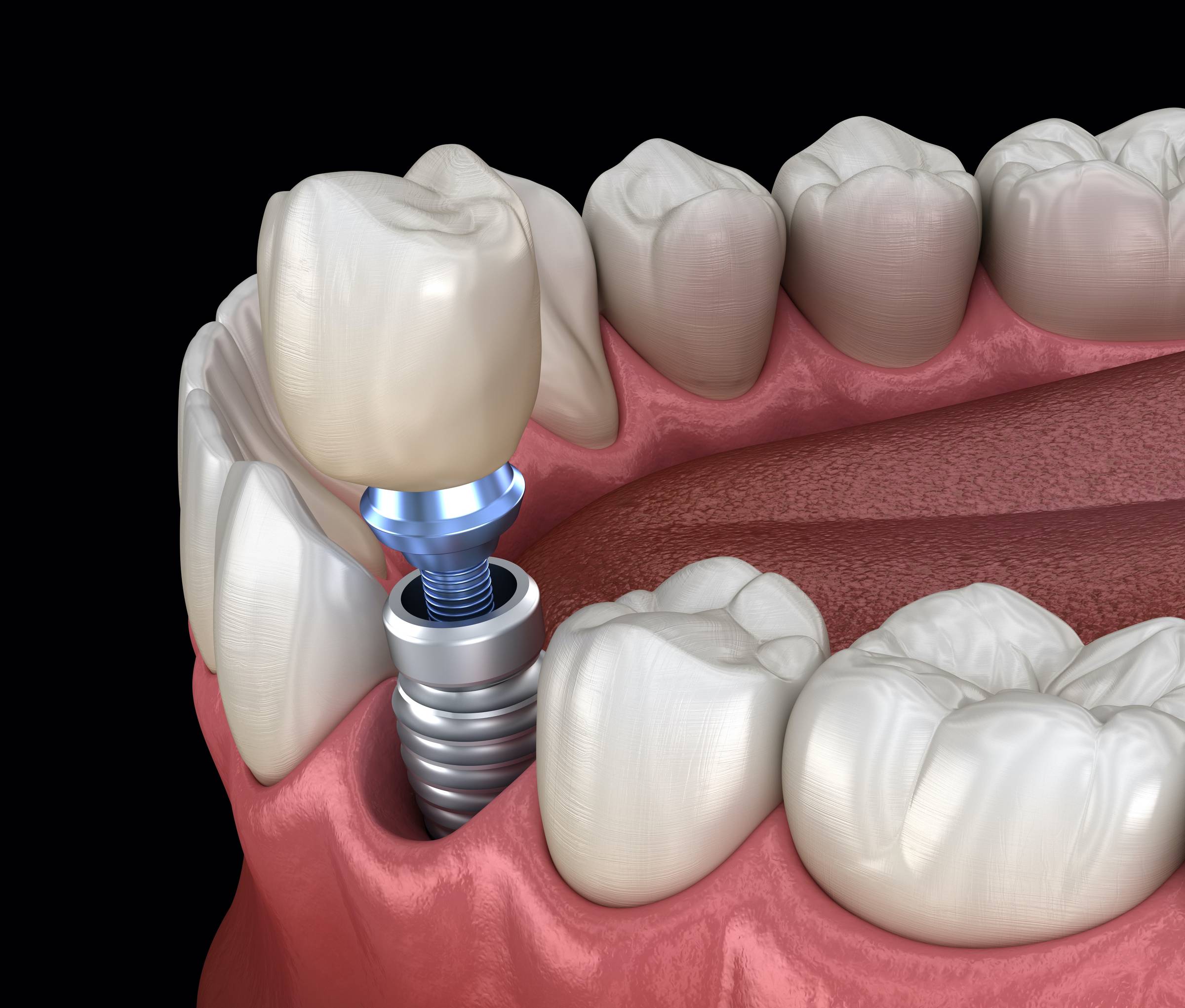 Dental professional smiling in front of dental equipment.
